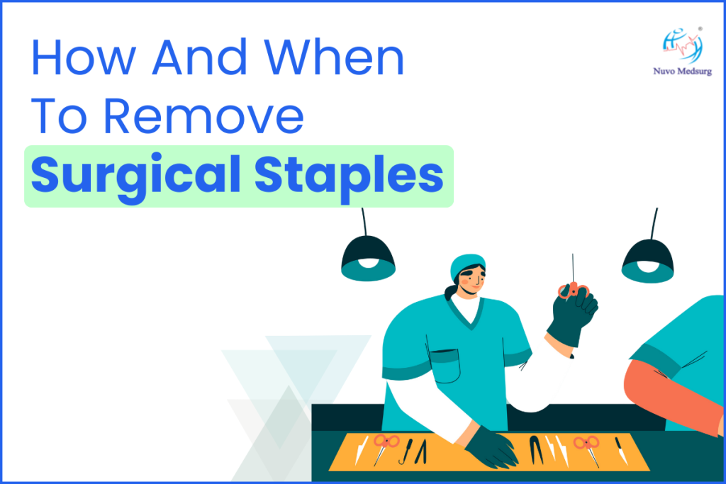 How And When To Remove Surgical Staples
