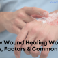 How Wound Healing Works 2 85x85