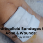 Hydrocolloid Bandages for Acne Wounds Do They Work 85x85