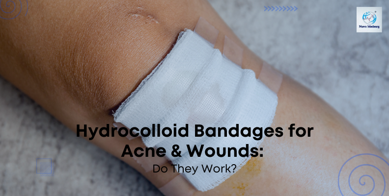 Hydrocolloid Bandages for Acne